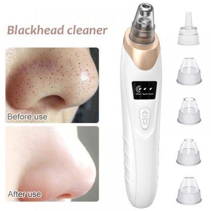 Electric Blackhead Suction Remover | Portable Pore Cleaner with 3 Suction Levels & 5 Probes