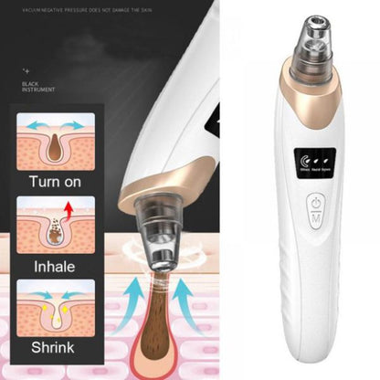 Electric Blackhead Suction Remover | Portable Pore Cleaner with 3 Suction Levels & 5 Probes